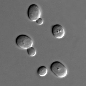 Saccharomyces cerevisiae - WikiCommons image Saccharomyces cervisae